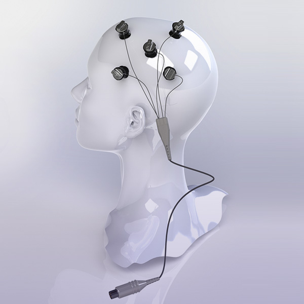 Curso de tDCS - Estimulação Transcraniana por Corrente Contínua