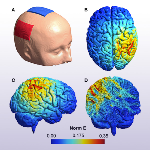 Neuronus | Curso: Técnicas de Estimulação Cerebral Não-Invasivas
